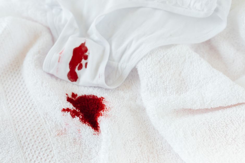 Removing lipstick stain from fabric