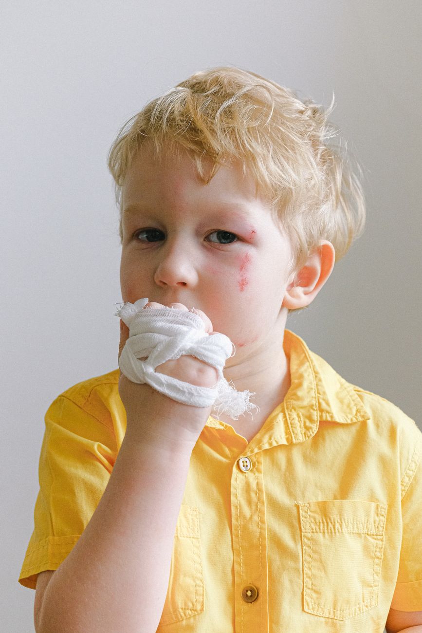 nosebleed, pinch nose, lean forward, correct method, first aid