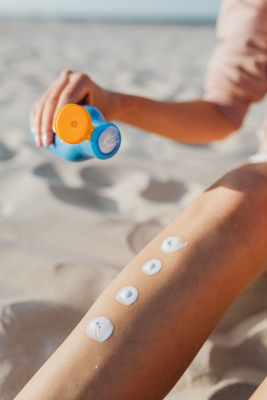 sunburn relief, aloe, yogurt, cool compress, black tea, after sun, kitchen hack